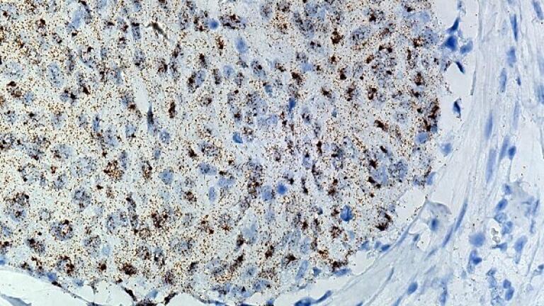 RNAscope® Technology Poised for Development as a Diagnostic Platform