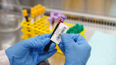 Extremely Durable Lab Identification Labels 