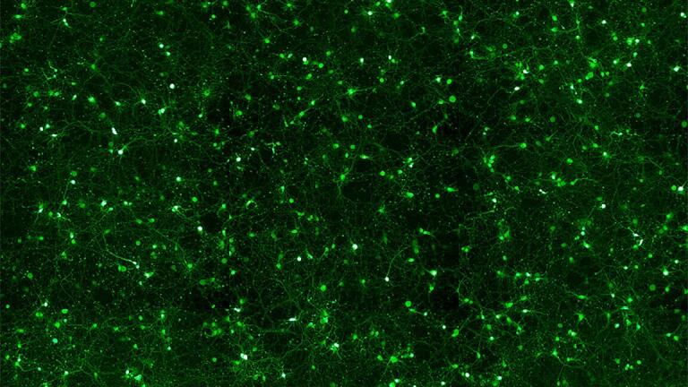 Highly Efficient Neural Transfection Reagent