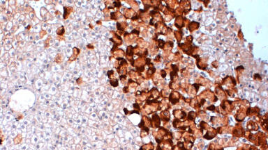 New Hepatitis B Reagents