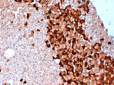 New Hepatitis B Reagents
