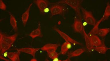 New Mycoplasma pneumoniae?Monoclonal Antibodies
