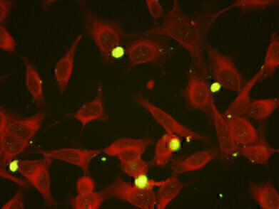 New Mycoplasma pneumoniae?Monoclonal Antibodies
