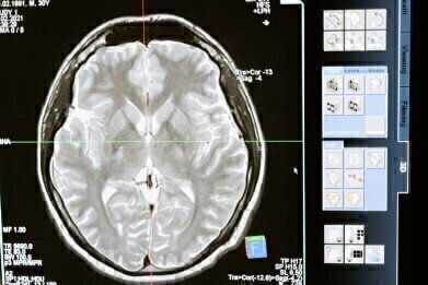 If We Can 3D Print Brain Tissue, What Will Be Next?