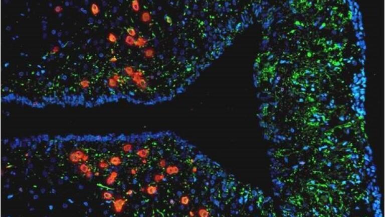 Partnership Extends Expertise in Pre-Clinical Imaging