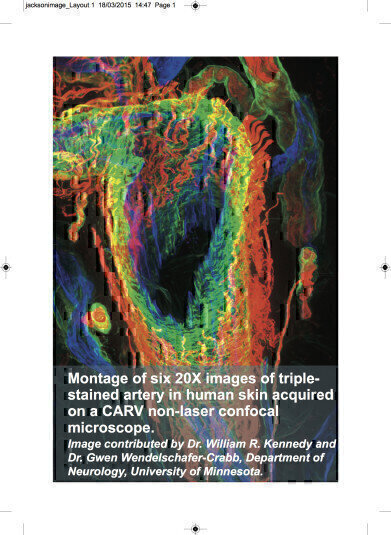 Secondary Antibodies Optimised for Immunohistochemistry
