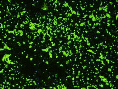 New Rabbit Monoclonal Antibody to Group A Strep
