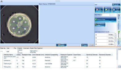 mASTer Software Speeds up Diagnosis of Superbug Antibiotic Resistance
