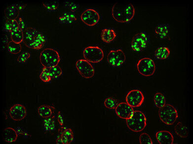 Super Resolution Microscopy Offers Method for Diagnosing Rare Bleeding Disorder
