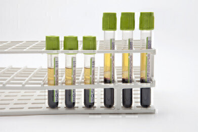 CE Mark for Next Generation Blood Separation Technology Received
