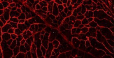 UCD Takes Lead on Cancer and Ophthalmic Research