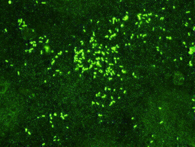 New Shigella Monoclonal Antibodies