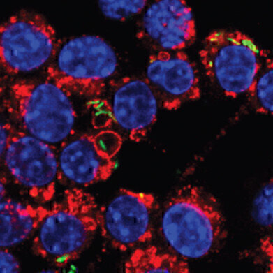 TB Defense Mechanism Discovered at Crick