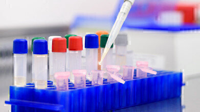 New Offering of Human Liver Microsomes for Drug Metabolism Studies Announced