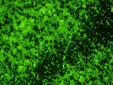 New Rabbit Monoclonal Antibody to Group B Streptococcus
