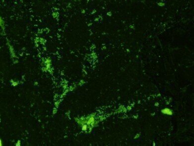 New Monoclonal Antibodies to Mycobacteria