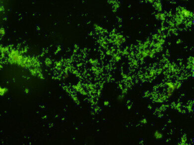 New Set of Monoclonal Antibodies to Gardnerella vaginalis Released