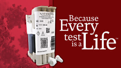 Antibody Test for COVID-19 Launched