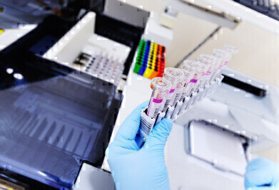 Rapid COVID-19 Diagnostic Infection Testing