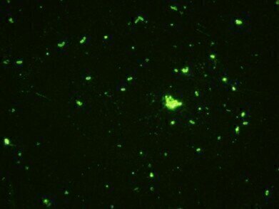 New Monoclonal Antibodies to Clostridia GDH