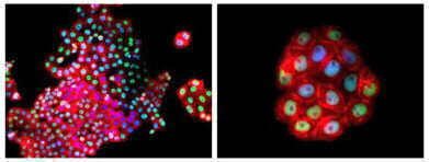 Patient-Derived Human Primary Cancer Cells