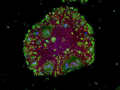 Are genetic differences the primary reason for susceptibility and severity of COVID-19?