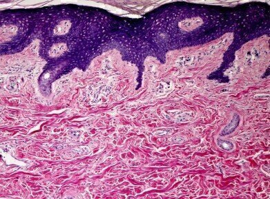 FFPE Tissue Blocks: Normal and Disease-State