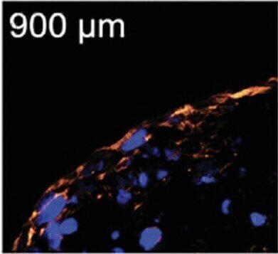 Creating Cell Repellent Surfaces in Microfluidic Devices