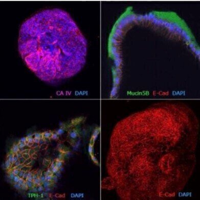 Gastrointestinal Organoid Biobank