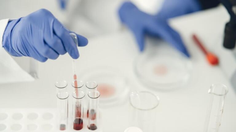 The Importance of Accurate Pipetting