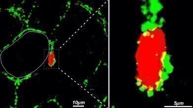 New Study Reveals the Role of Heparan Sulfate in Obesity