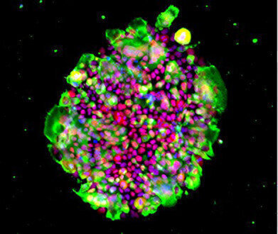 Expanded Range of Laminin isoforms