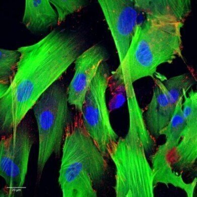 Fast Creation of Custom Cell Lines