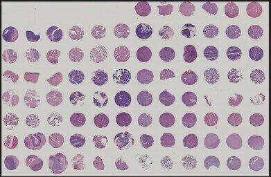 FDA-compliant tissue microarrays