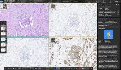 Digital pathology platform delivers comprehensive diagnostics