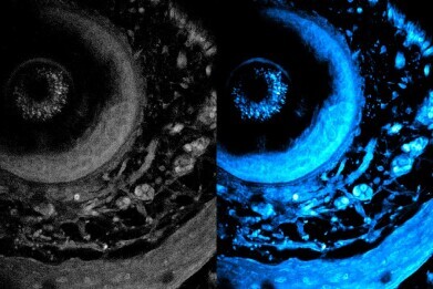 MIT non-invasive imaging method uses high-powered lasers to penetrate ever deeper into living tissue