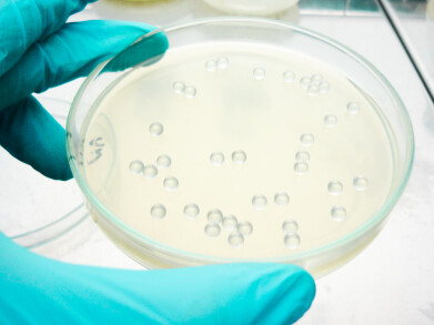 Optimised plating of bacterial and yeast cells on agar plates