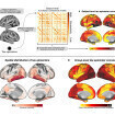 Detangling tau: Patient scans reveal how amyloid and tau proteins work in tandem in Alzheimer&rsquo;s disease