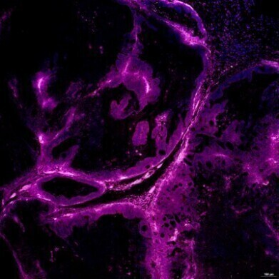 Defined hydrogel enables reliable cancer cell culture in xenograft models