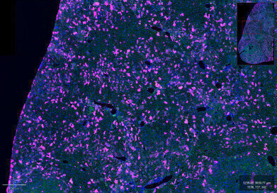 New Anti-GFP antibodies enhance fluorescent protein detection