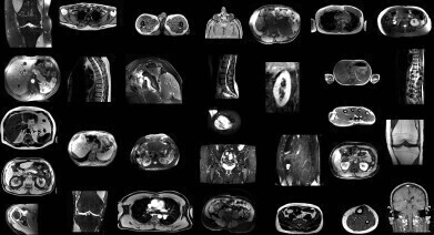 Artificial intelligence model automatically segments MRI scans