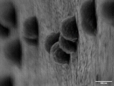 Copper nanotech coating could make implants infection-proof