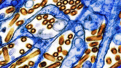 Viewpoint: Prepare now for a potential H5N1 pandemic
