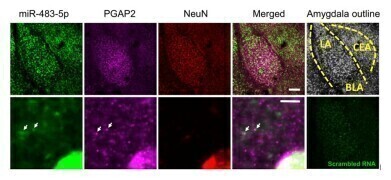 MicroRNA miR-483-5p found to ease anxiety in response to stress