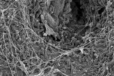 How the cholera bacterium can outsmart a virus