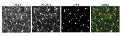 Fast-track neural cell production with iPSC differentiation kits