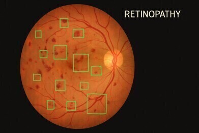 Wide-field, quantitative OCT angiography with spectrally extended line field technology