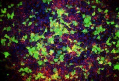 High-performance transfection reagent for diverse cell lines 