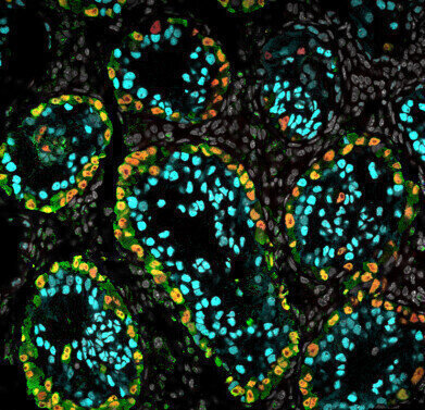 iPSC protocol advances research into male infertility treatments