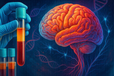 Blood test markers identified which can detect brain insulin resistance linked to type 2 diabetes